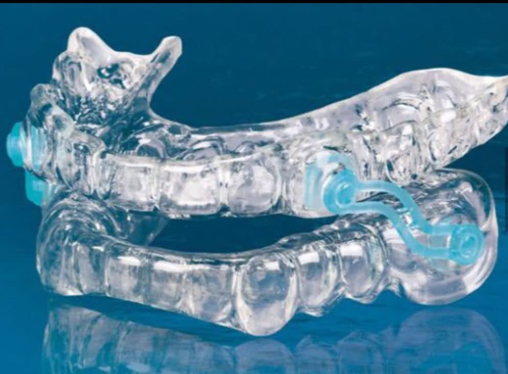 daybreak mandibular advancement oral appliance