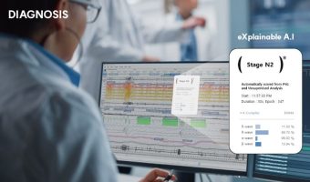 AI Sleep Diagnostic Software Somnum Debuts in US 